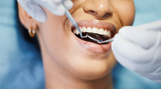 Best Emergency Dental Care for Abscessed Tooth in Arkwright, SC