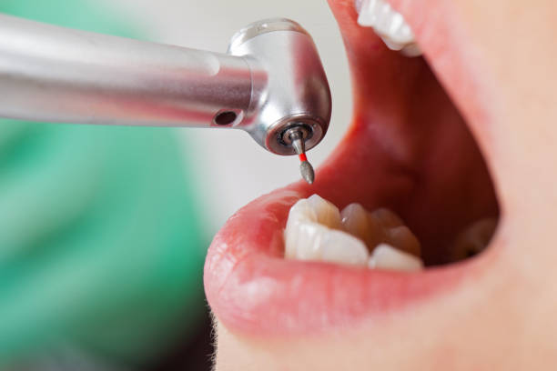Best Mobile Emergency Dentist in Arkwright, SC